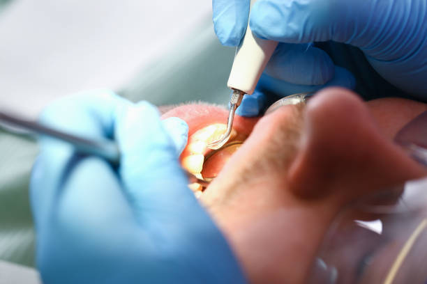 Best Emergency Treatment for Dental Infections or Abscesses in Haskell, AR