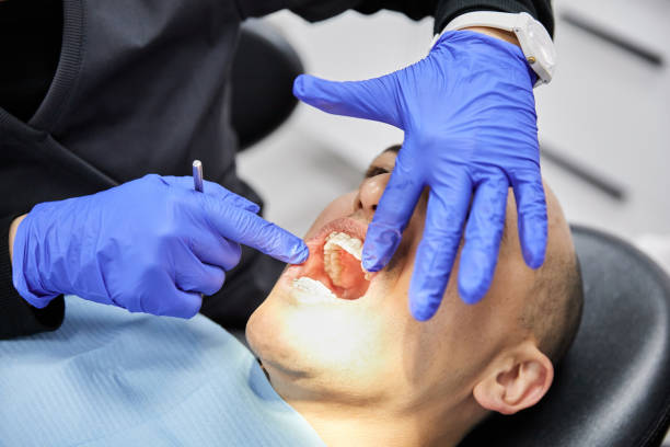 Best Emergency Wisdom Teeth Removal in Haskell, AR