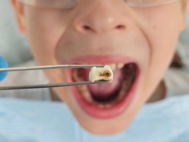 Best Same-Day Emergency Dental Services in Haskell, AR