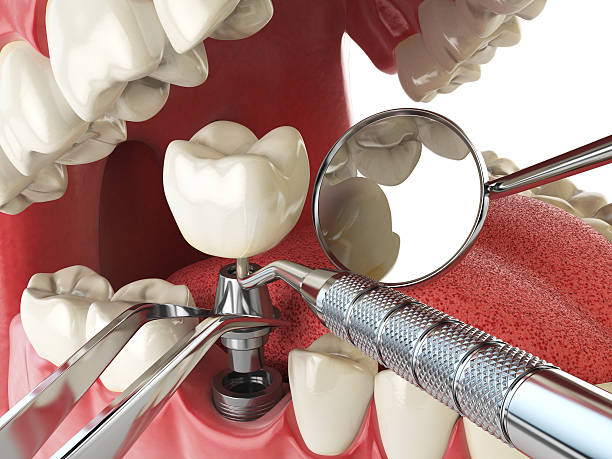 Best Urgent Care for Lost Fillings or Crowns in Haskell, AR